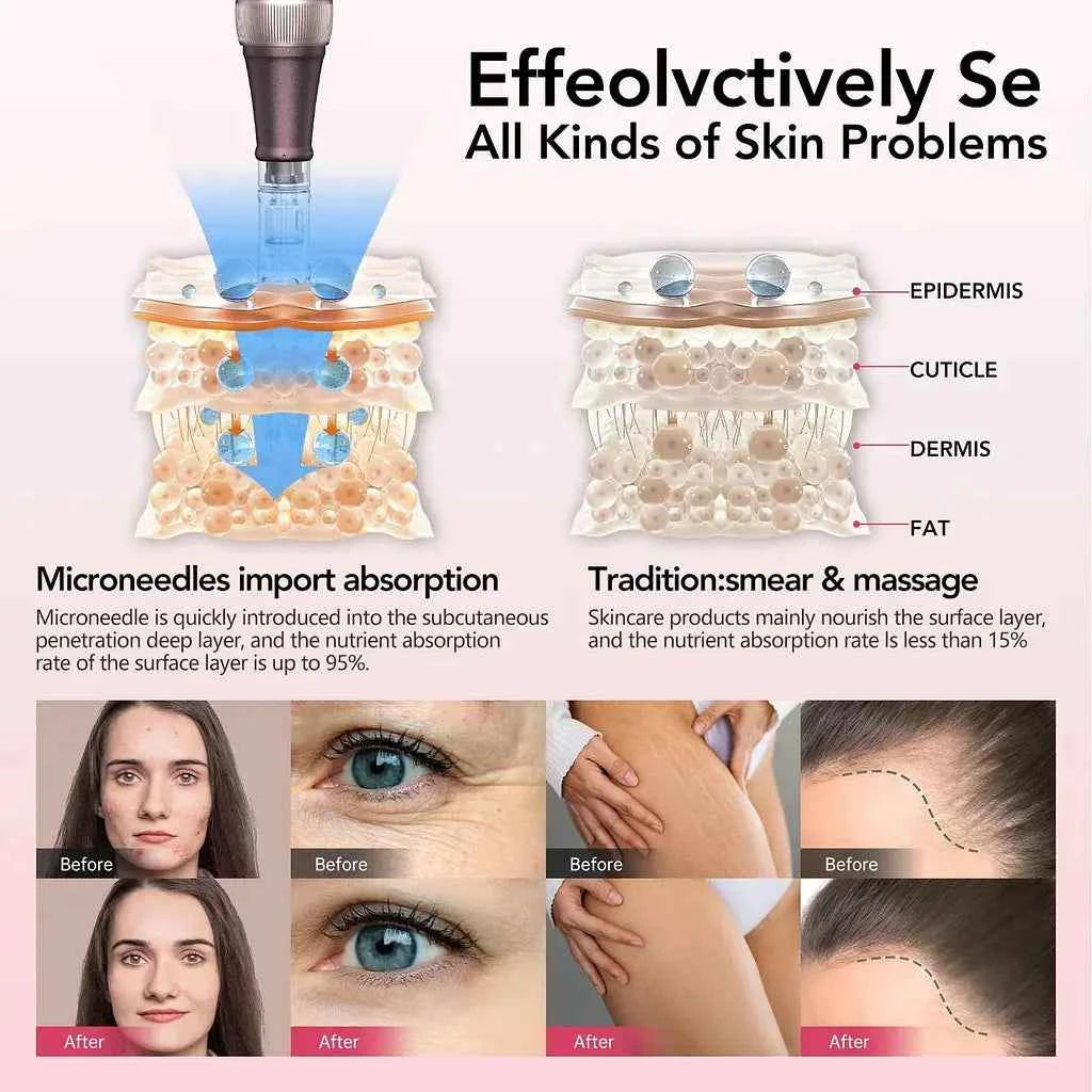 Dr. Pen A10 Microneedling Pen con cartuchos – Ultima A10 Kit - Dermapen