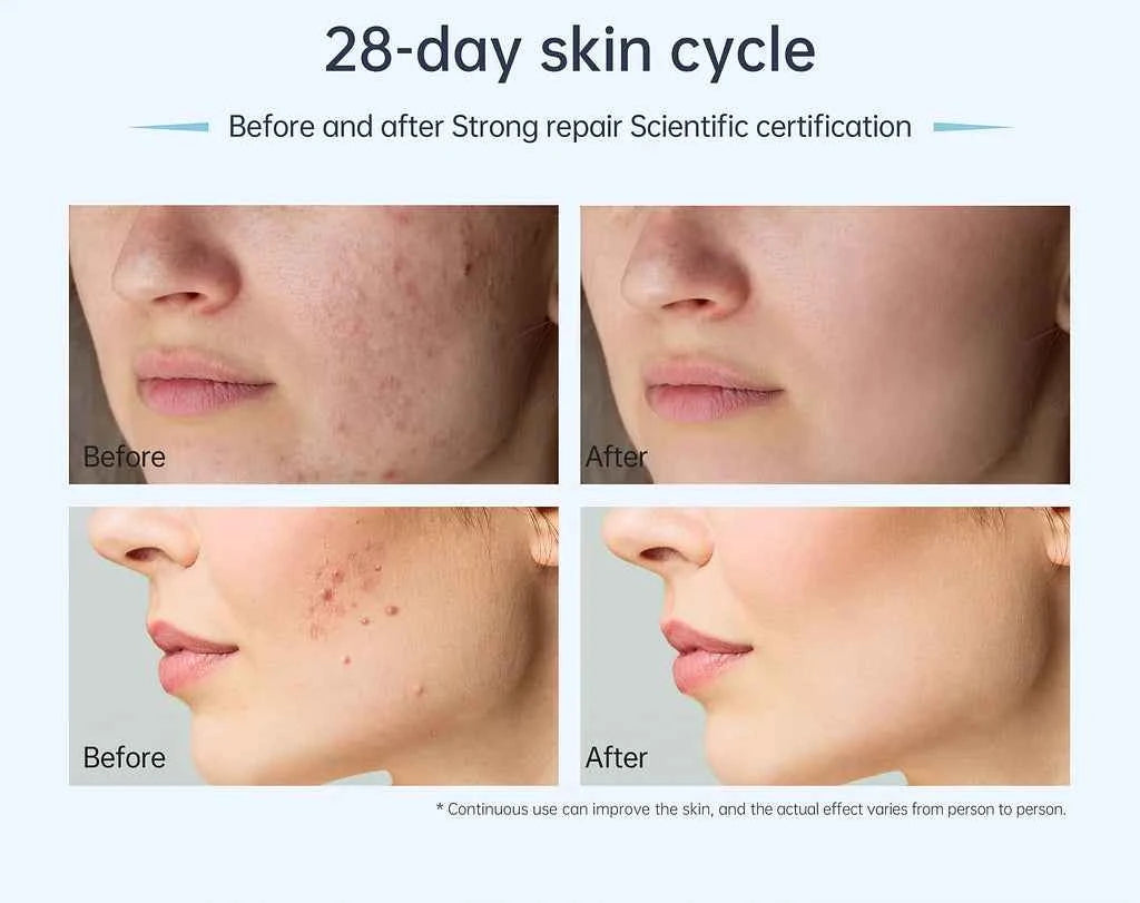 Dr. Pen A11 : penna professionale per microneedling