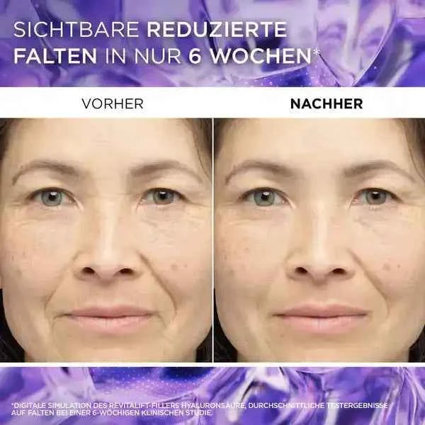 Sérum repulpant L'Oréal Paris Revitalift Filler [+Acide hyaluronique] 