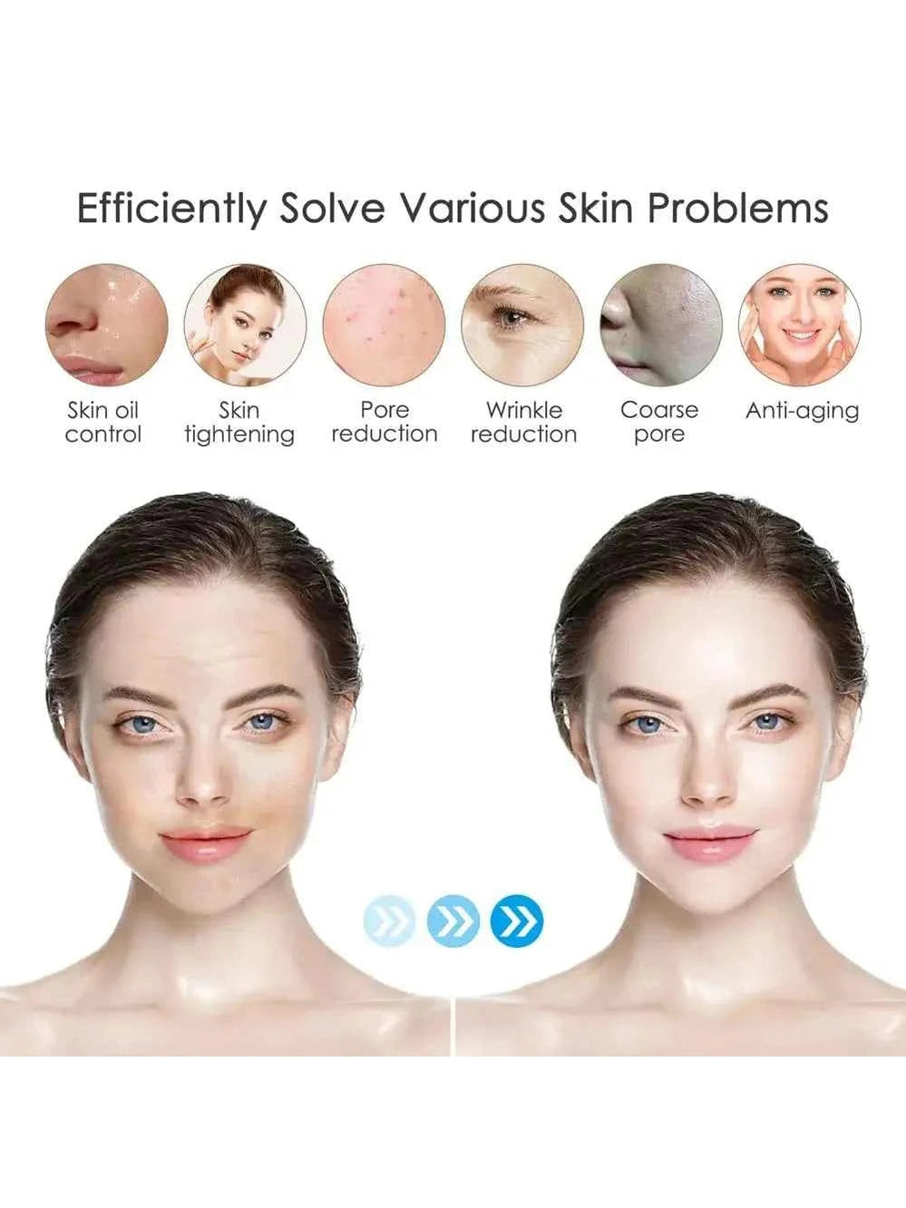 Dr. Pen M8 Microneedling Pen con cartuchos - microneedling profesional un casa - Ultima M8 Kit